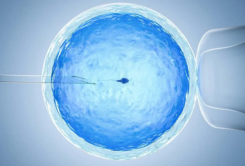 Laser-Assisted Hatching in IVF
